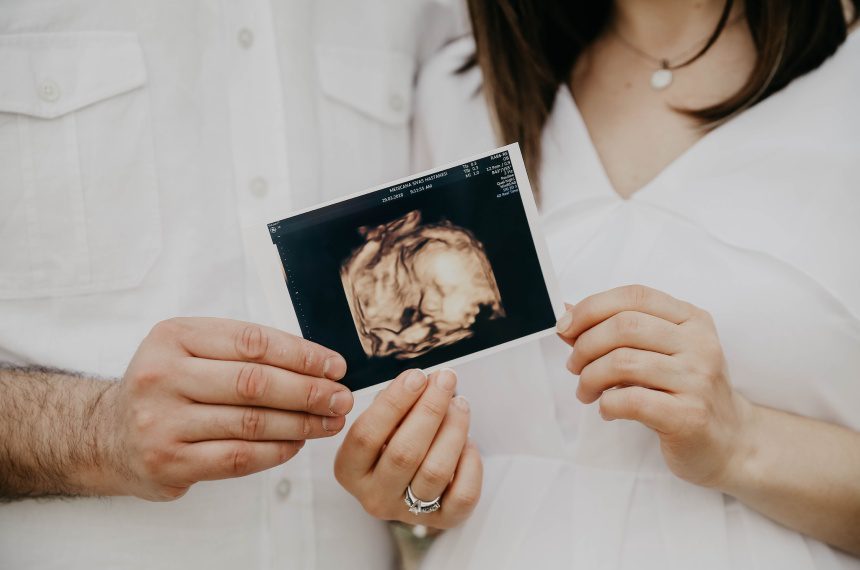 A woman holding up an ultrasound picture of her baby.